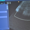 УЗД апарат SIEMENS ANTARES ACUSON PREMIUM EDITION