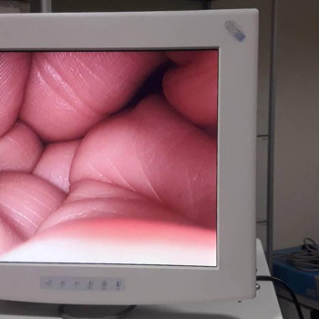 Медичний монітор NDS 18 дюймів