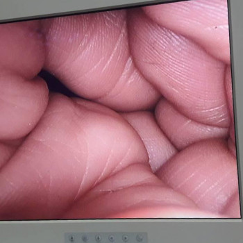 Медичний монітор NDS 18 дюймів