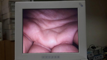 Медичний монітор NDS 18 дюймів