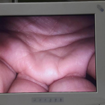 Медичний монітор NDS 18 дюймів