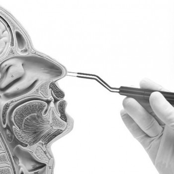 Біполярний електрод для каутеризації носової раковини Ellman