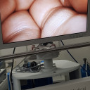 Монітор медичний хірургічний NDS 23 дюйми. Full HD (США)