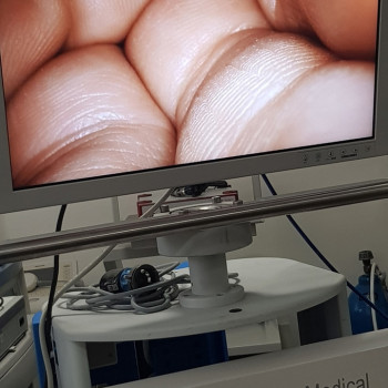 Монітор медичний хірургічний NDS 23 дюйми. Full HD (США)