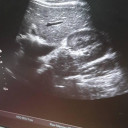 УЗД апарат експертного класу TOSHIBA APLIO XG