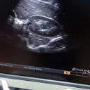 УЗД апарат експертного класу TOSHIBA APLIO XG