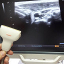 УЗД апарат експертного класу TOSHIBA APLIO XG