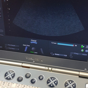 Портативний УЗД сканер GE VOLUSON E (2011 р.в.)