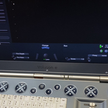 Портативний УЗД сканер GE VOLUSON E (2011 р.в.)