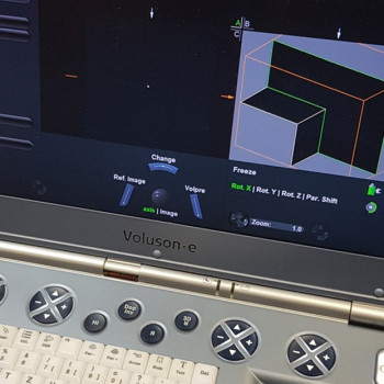 Портативний УЗД сканер GE VOLUSON E (2011 р.в.)