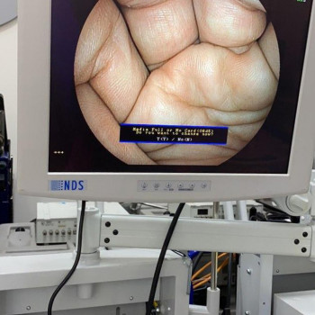 Ендоскопічна стійка FUJINON 4400 HD