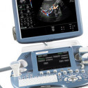 УЗД апарат GE Voluson E8 Expert