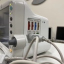 Монітор пацієнта GE Dash 3000