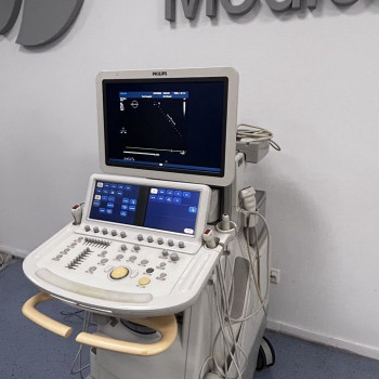 УЗІ апарат експертного класу Philips IE33