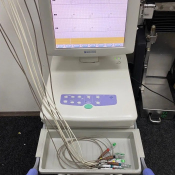 УЗД апарат Toshiba Famio 8