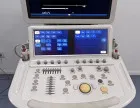 УЗІ апарат експертного класу Philips IE33