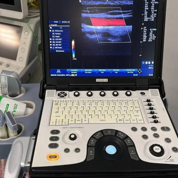 Портативний ультразвуковий сканер GE LOGIQ e