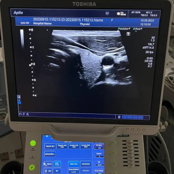 Ультразвуковий діагностичний апарат Toshiba Aplio 500 (TUS-A500) серія Platinum