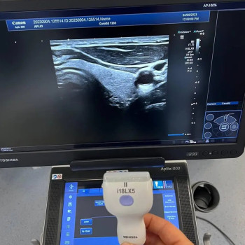 Ультразвуковий діагностичний апарат Toshiba Aplio i800