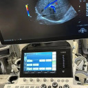 УЗД апарат експертного класу GE LOGIQ S7 з технологією XDclear 2.0