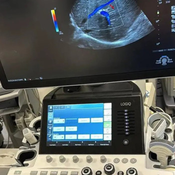УЗД апарат експертного класу GE LOGIQ S7 з технологією XDclear 2.0