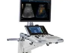 УЗД апарат експертного класу GE LOGIQ S7 з технологією XDclear 2.0