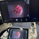 УЗД апарат експертного класу GE Voluson E8