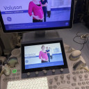 УЗД апарат експертного класу GE Voluson E8
