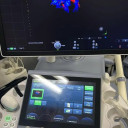 УЗД апарат експертного класу GE Voluson E8