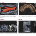 УЗД апарат експертного класу Siemens ACUSON S1000 HELX Evolution