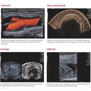 УЗД апарат експертного класу Siemens ACUSON S1000 HELX Evolution