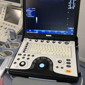 УЗД портативний сканер GE Logiq e