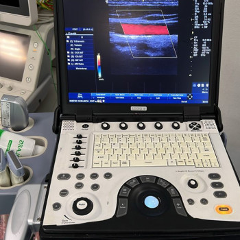 УЗД портативний сканер GE Logiq e