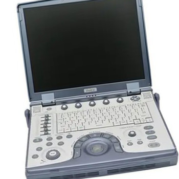 УЗД портативний сканер GE Vivid e